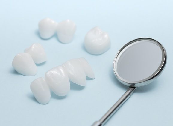 A variety of metal free dental restorations