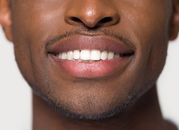 Man with white teeth after visiting Brooklyn cosmetic dentist 